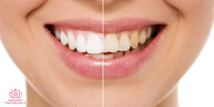 مزایای استفاده از بهترین مارک های پودر سفید کننده دندان