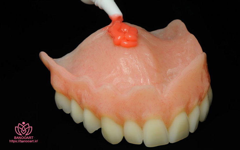 عوارض استفاده از چسب دندان مصنوعی